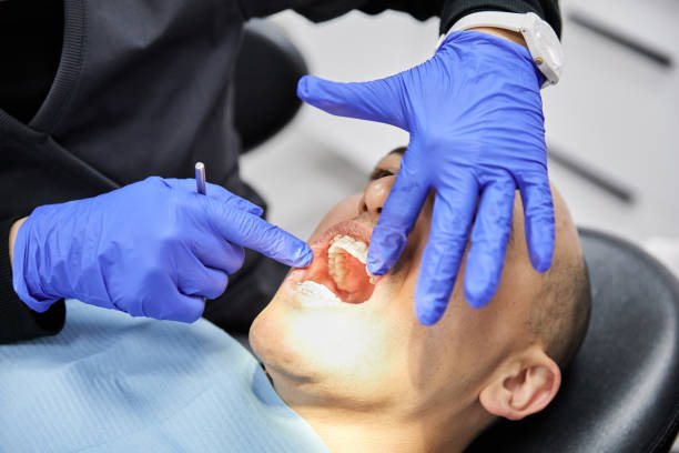 Best After-Hours Dental Trauma Care in Cross Mountain, TX